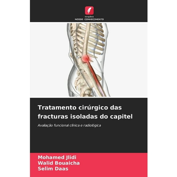 Tratamento cirúrgico das fracturas isoladas do capitel, (Paperback)