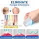thumbnail image 4 of 2024 Nail Fungus Cleaning Laser Device,nail Fungus Laser Treatment Device For Toenail New, 4 of 5