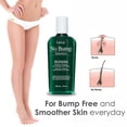 thumbnail image 4 of GiGi No Bump Solution Ingrown Hair Treatment, Skin Smoothing After Wax Care for Shaving and Waxing, 8 fl oz, 4 of 8