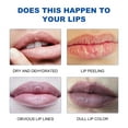 Blackheads On Lip Line Removal - 7ssu92g