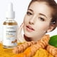 thumbnail image 4 of Turmeric Dark Sp-ot Corrector Seru-m High Gloss Skin Care Moisturizing Repair Seru-m 30ml, 4 of 9