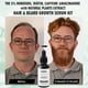 thumbnail image 3 of Sérum para el crecimiento del cabello y la barba BY BARNEY 5% Minoxidil, 3 of 8
