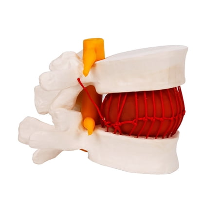 Human lumbar intervertebral disc demonstration model bone model human ...