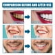 thumbnail image 3 of Enjuague bucal, eliminación de sarro, blanqueamiento dental, curación de aftas bucales, eliminación del mal aliento y caries. Enjuague bucal de 100 ml., 3 of 5