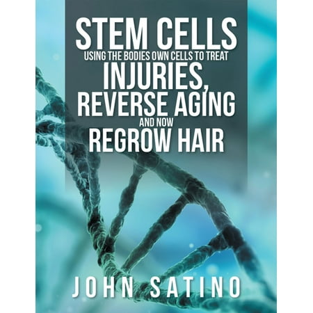 Stem Cells Using the Bodies Own Cells to Treat Injuries, Reverse Aging and Now Regrow Hair - (Best Way To Regrow Hair On Crown)