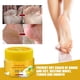 thumbnail image 2 of Crema para el talón agrietado, crema de plátano para el cuidado de los pies, alivia la piel seca y áspera, crema para grietas antisequedad, 2 of 6