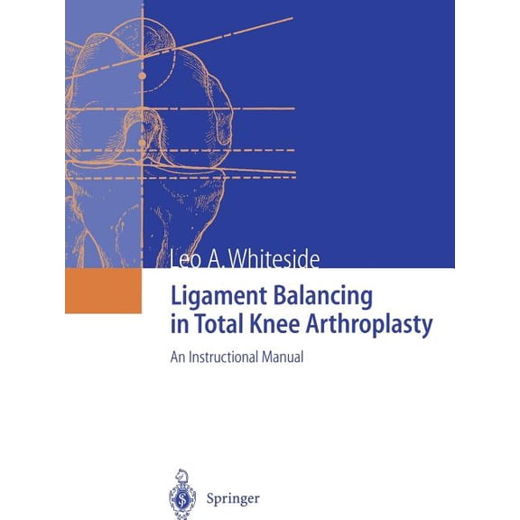 Ligament Balancing in Total Knee Arthroplasty: An Instructional Manual, (Paperback)