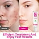 thumbnail image 5 of Azelaico 12% Acné Crema: Premium Azelaic Crema Facial - Alivio de enrojecimiento de la cara, enrojecimiento de la reducción de cuidado de la piel, evitar los brotes de acné, Ease Pimple,20g, 5 of 8