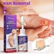thumbnail image 2 of Corn And Calluses Remover Gel Foot Callus Removal Treatment Hard Skin Pedicure, 2 of 5