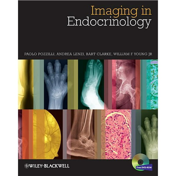 Imaging in Endocrinology, (Hardcover)