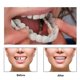 thumbnail image 1 of Snap On Smile Silicone Artificial Teeth Dentures--, 1 of 5