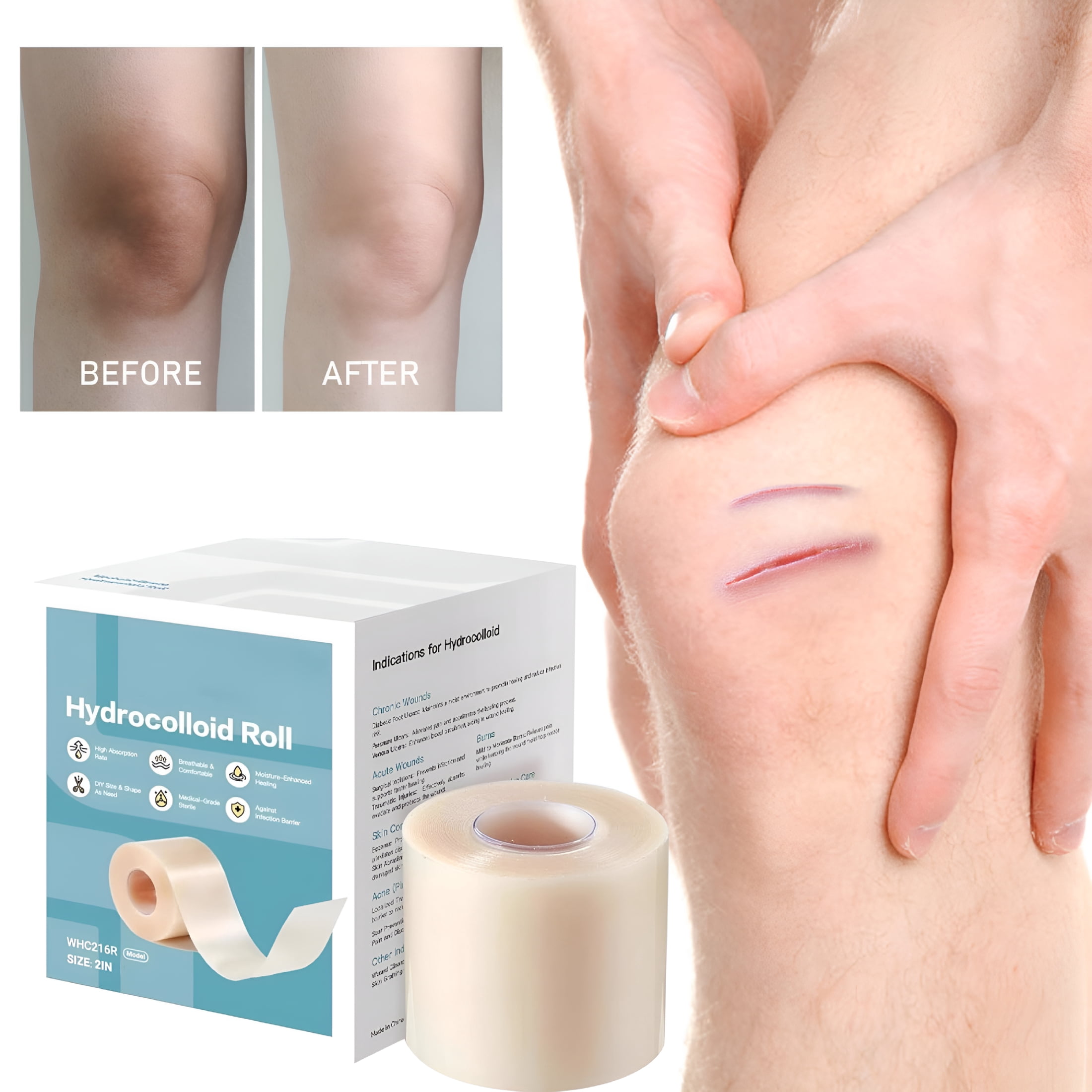 die cutting hydrocolloid dressings Dressing Roll for Wound Care, 2in*16ft, Cut-to-Size Patch, Hydrocolloid Bandages with Self-Adhesive, Ultra Absorbent, Flexible & Waterproof, First Aid Kit Essential Tape Color:Blue Mint Capella Apparel Co. TACRAI Strapless Black Dress contouring material moves with