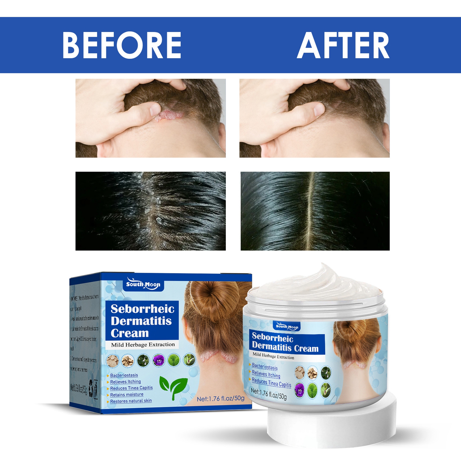 Mightlink 50g/Box Itchy Skin Cream Nonirritating Easy to Absorb