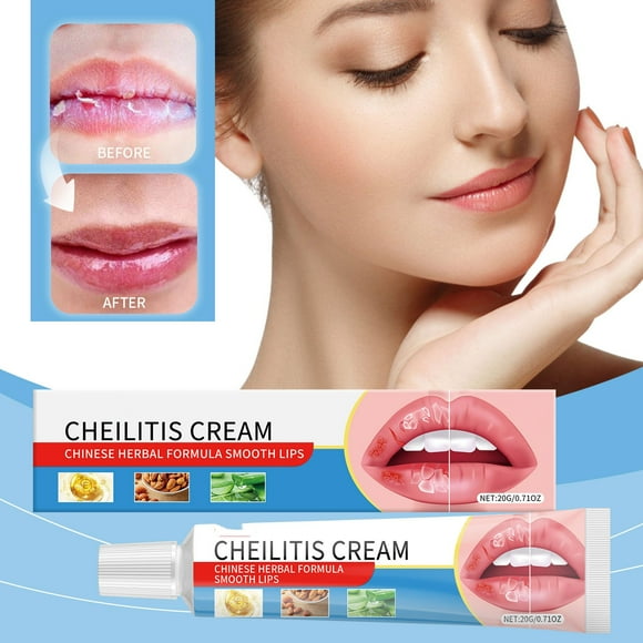 CYC Ch Eilitis C Ream Deeply Nourish The Lip Skin And Reduce Dryness And Cracking