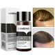 thumbnail image 4 of Tratamiento anticaída para el crecimiento del cabello, suero de esencias para hombres, 4 of 8