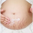 thumbnail image 4 of Postpartum Elegance Natural Deep Stretch Mark Removal Cream for Pregnancy - Scar Repair, Abdominal Firming, and Gentle Stretch Mark Eradication, 4 of 9