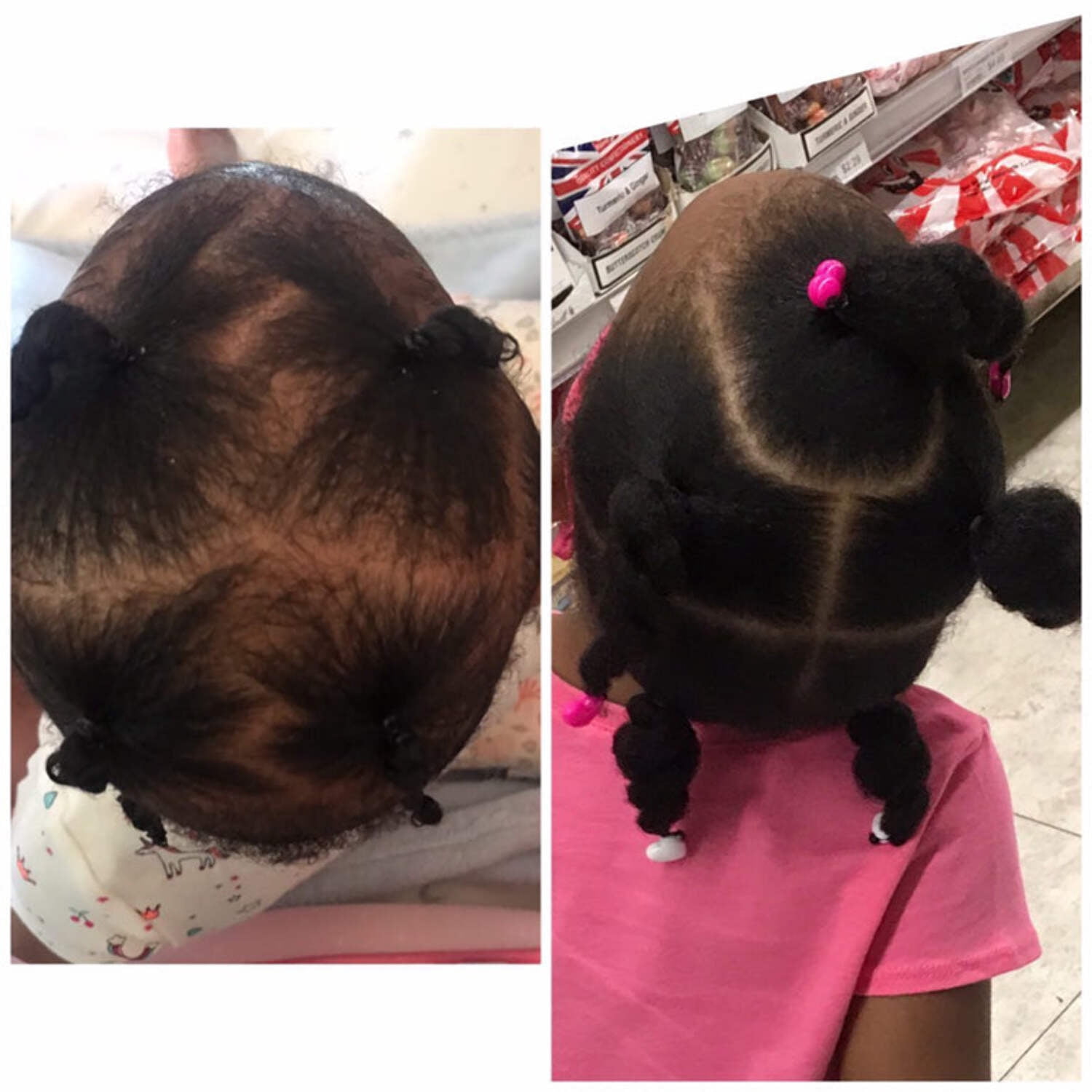 J'Organic Solutions Hair Growth Kit for Kids, 4-Piece Natural Hair Care Bundle