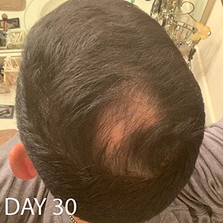 Biotin Hair Growth Shampoo Biotin Vitamin Shampoo For Hair Loss