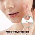 thumbnail image 3 of Hitworker 400pcs Hydrocolloid Pimple Patches - Salicylic Acid Acne Patches for Sensitive Skin, 3 of 8