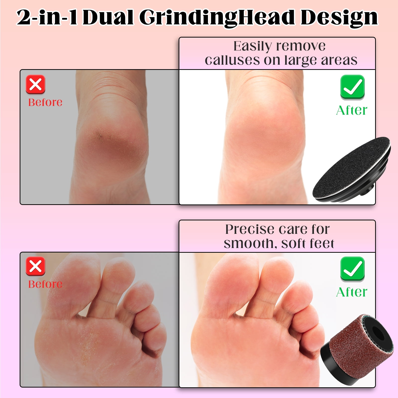 2 In 1 Electric Foot Grinder with Replacement Head Portable Feet File Pedicure Tool Foot Scrubber Callus Dead Skin Remover with Sandpaper Disk Nail Drill Bits