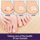 thumbnail image 4 of EELHOE 50Pcs Elastic Ingrown Toenail Correction Stickers Elastic Adhesive Relieve Feet, 4 of 5