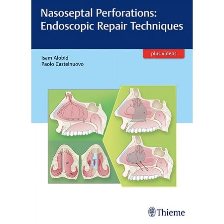 UPC: 9783132053915 | Nasoseptal Perforations: Endoscopic Repair Techniques (Hardcover)