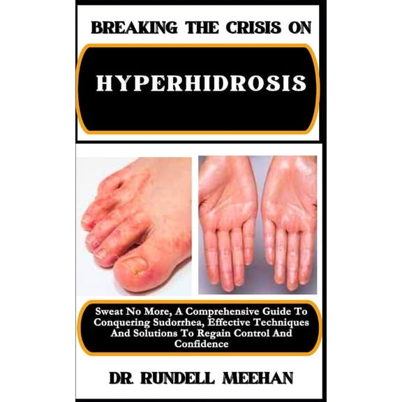 Breaking the Crisis on Hyperhidrosis: Sweat No More, A Comprehensive Guide To Conquering Sudorrhea, Effective Techniques And Solutions To Regain Control And Confidence (Paperback)
