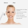 thumbnail image 1 of Facial Machine,Multi-functional Face Lift Facial Skin Rejuvenation Removal Wrinkle Anti Aging Skin Care Beauty Machine for Home Use, 1 of 7