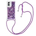 thumbnail image 3 of Funda FOXDOCK para Motorola Moto G Play 4G 2024 con Cuerda Ajustable, Brillo Líquido, Protección Antigolpes y Lente – Ideal para Regalo, 3 of 6