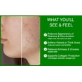 thumbnail image 5 of Dr. Speron's Natural Scar Removal Cream for New & Old Scars, Advanced Silicone Scar Gel for Surgical Scars, Pimples, Burns, and Dark Spots - 1.41oz, 5 of 6