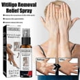 thumbnail image 4 of White Spot Repair Spray Repair Desalination White Spot Spotted Tw, 4 of 5