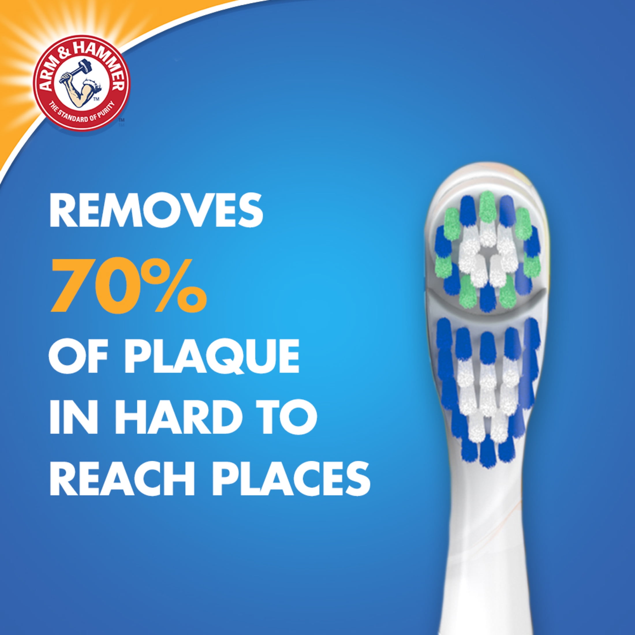 Spinbrush PRO+ Gum Health Battery Powered Toothbrush for Adults, Helps Plaque Removal, Soft Bristles