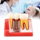 thumbnail image 1 of Modelo dental Higoodz Resina Dental Demostración Educativa Diente Análisis de implantes 10.5 x 7 x 8 cm, 1 of 5