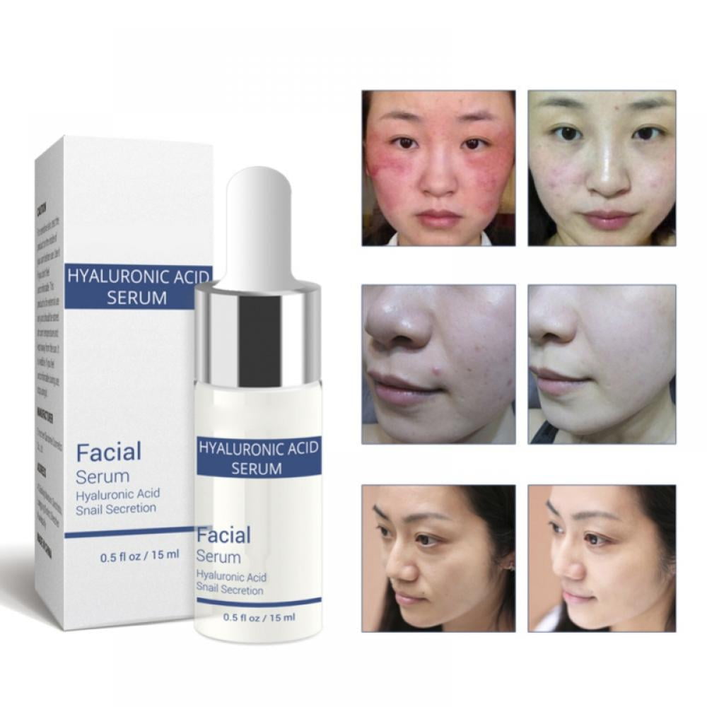 Kernelly Hyaluronic Acid Snail Serum Whitening Anti-Aging Moisturizing Essence Repair Damaged Skin