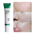 thumbnail image 3 of Crema de ácido salicílico 20ml Eliminación de poros/acné y blanqueamiento/brillo/blanqueamiento/anti-manti/Control de aceite, 3 of 3