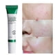 thumbnail image 3 of Crema de ácido salicílico 20ml Eliminación de poros/acné y blanqueamiento/brillo/blanqueamiento/anti-manti/Control de aceite, 3 of 3