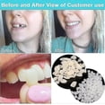 thumbnail image 2 of 2pcs Temporary Tooth Repair Kit For Filling The Missing Broken Tooth And Gaps-moldable Fake Teeth, 2 of 5