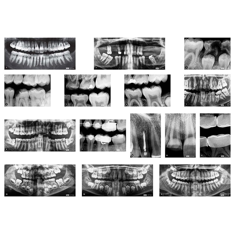 DENTAL XRAYS
