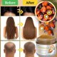 thumbnail image 5 of Dr. Sebi 100% Natural, Unrefined and Organic Batana Oil from Honduras for Hair Growth - Enhances Hair Thickness, Prevents Loss for Men & Women, 5 of 7