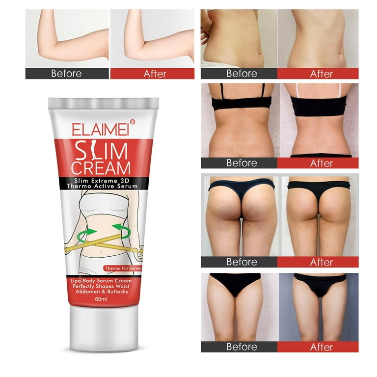 Discover the Benefits of Saloni Body Toner Kit: Reduce Cellulite and T –