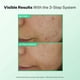 thumbnail image 2 of Limpiador StriVectin Multi-Action Clear Gentle 150 ml para el acné, 2 of 7