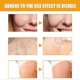 thumbnail image 5 of Jaysuing anti-acne and anti-pimple serum |, 5 of 5