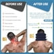 thumbnail image 3 of Dispositivo de tracción cervical para aliviar el dolor de cuello. Collarín inflable ajustable y aparato de tracción cervical. Dispositivo de descompresión cervical para uso doméstico (azul)., 3 of 7
