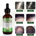 thumbnail image 2 of 3pcs Rosemary Essential Oil Hair Growth Loss & Skin Care Treatment Pure Oils, 2 of 5