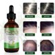 thumbnail image 2 of Rosemary Essential Oil Hair Growth Loss & Skin Care Treatment Pure Oils, 2 of 5