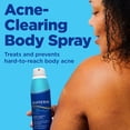 thumbnail image 2 of Spray corporal para el acné Differin 360 con ácido salicílico 180 ml, 2 of 8