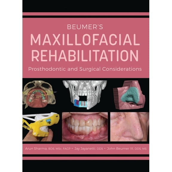 Beumer's Maxillofacial Rehabilitation: Prosthodontics and Surgical Considerations, (Hardcover)