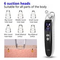 thumbnail image 2 of XIRQI 2026 New Face Nose Acne Black Dot Pimple Blackhead Remover Electric Blackhead Vacuum Cleaner Pore Care Machine, 2 of 7