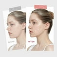 thumbnail image 3 of Mascarilla de gel lifting V-line ROUND LAB Camellia Deep Collagen, 3 of 8