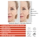 thumbnail image 5 of Set de parches antiarrugas DosensePro para la frente y la cara de silicona, 5 of 8